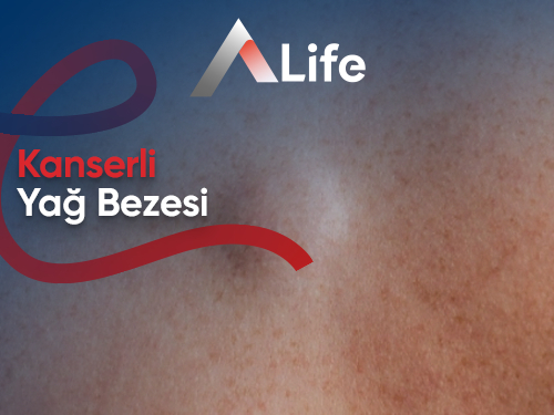 Kanserli Yağ Bezesi Belirtileri